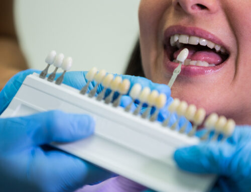 Czy implanty zębów bolą? Prawda o bólu podczas i po zabiegu